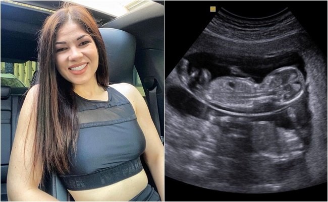 🔥 LEDÖBBENT az egész ország! 😳 Gáspár Evelin mostani megszólalása mindenkit váratlanul ért… senki sem számított erre a fordulatra!  👶 Valóban úton van a baba? Vagy valami egészen más áll a háttérben? A kijelentése után beindultak a találgatások…  💥 Egy mondat, ami mindent megváltoztathat – de a teljes történet még csak most kezd kibontakozni…  👇 A részletek és a meglepő fordulat a kommentek között!